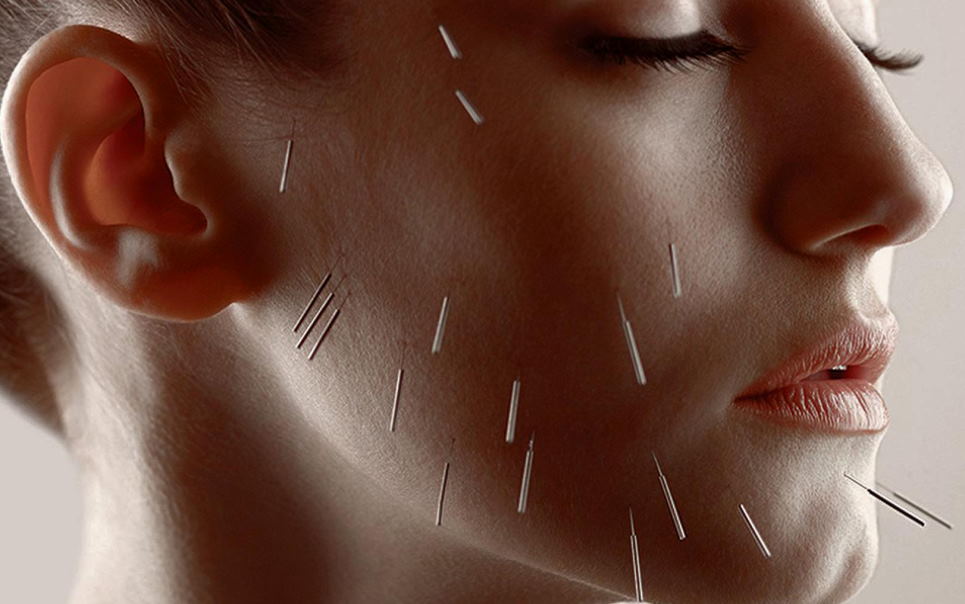 acupuncture increase collagen production